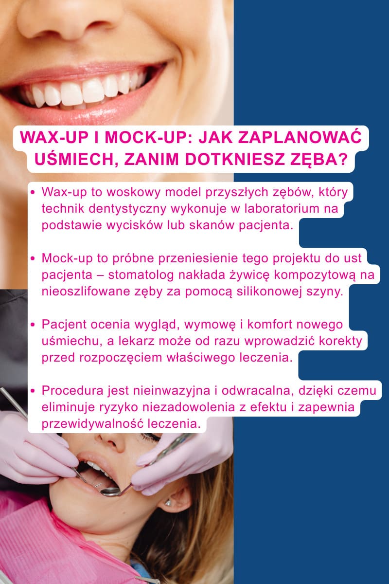 Wax-up i mock-up: jak zaplanować uśmiech, zanim dotkniesz zęba?